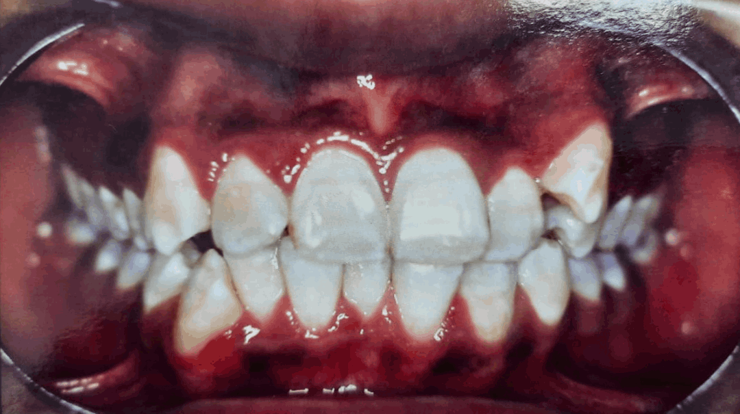 p1